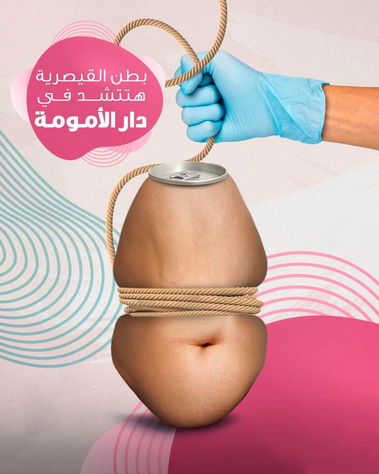 Égypte. Accoucher à ventre ouvert : quand la césarienne devient la norme | Babelmed