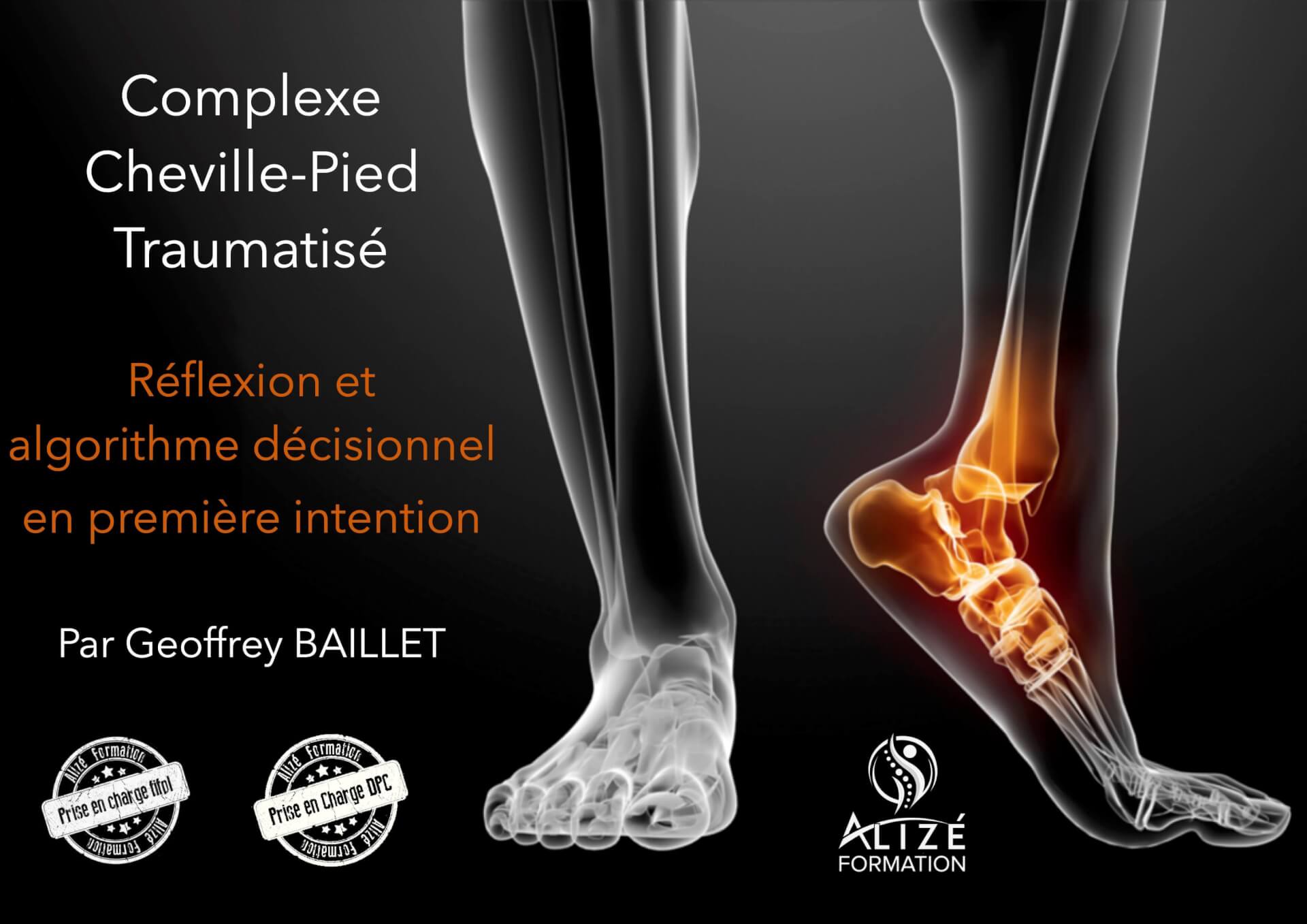 Formation Cheville-pied en première intention - Rennes 11 & 12 septembre 2020 | Alizé - Syndicat de kinésithérapeutes