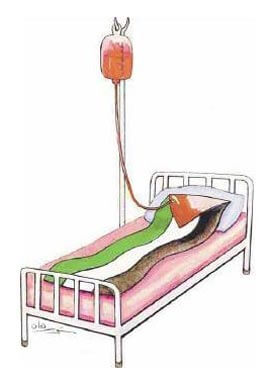 Les perfusions européennes maintiennent le régime palestinien en vie | Babelmed