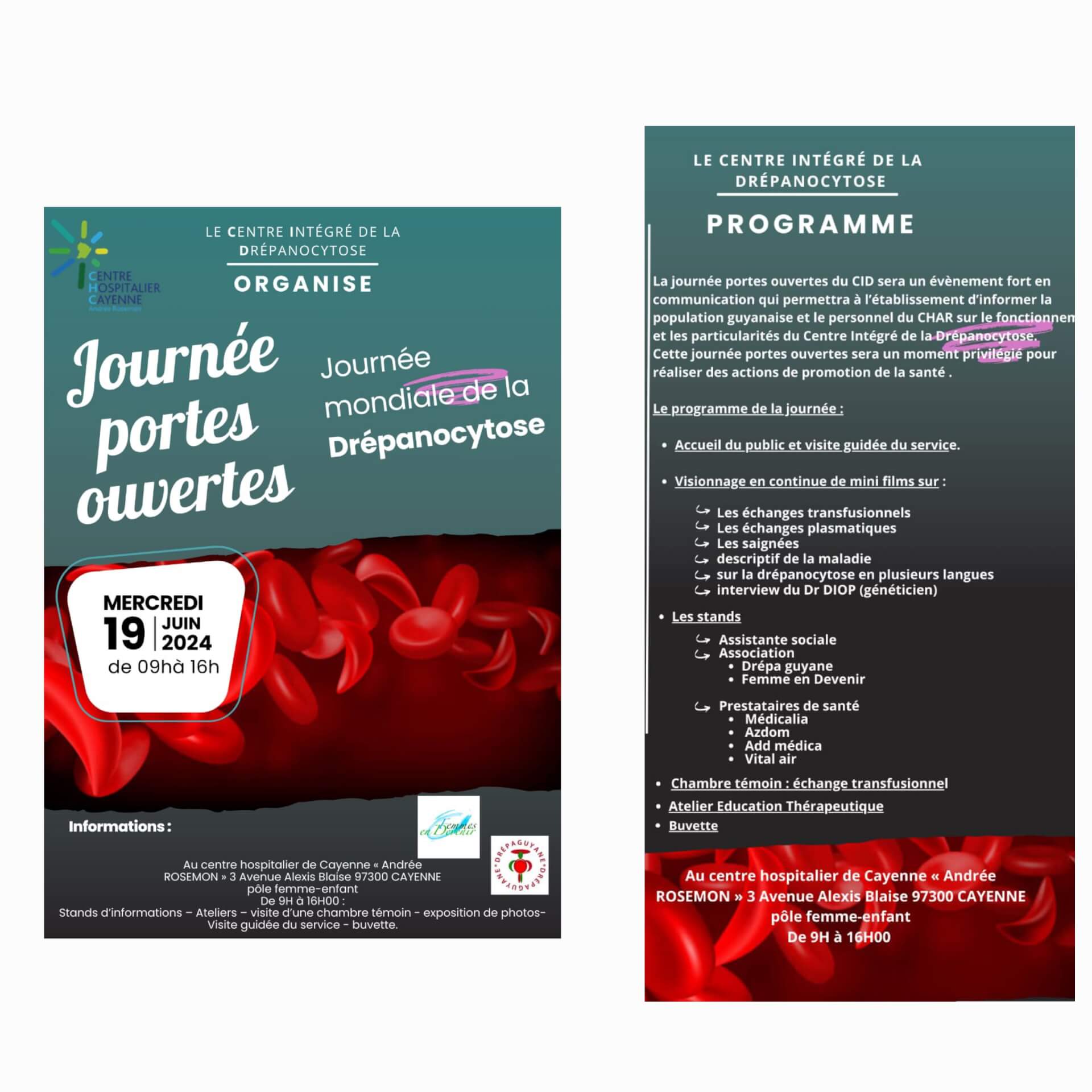 Journée mondiale de la Drépanocytose | DrepaGuyane