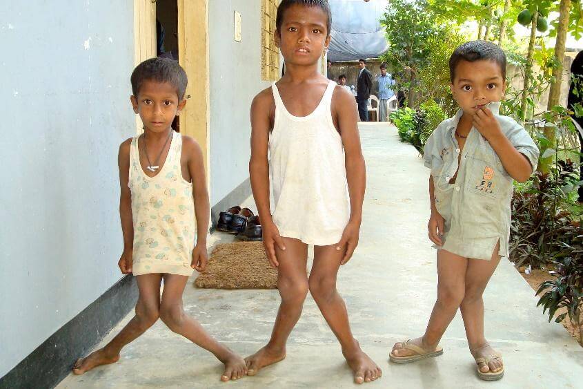 Lutte contre le handicap de l’enfant | Aide Médicale et Développement - AMD