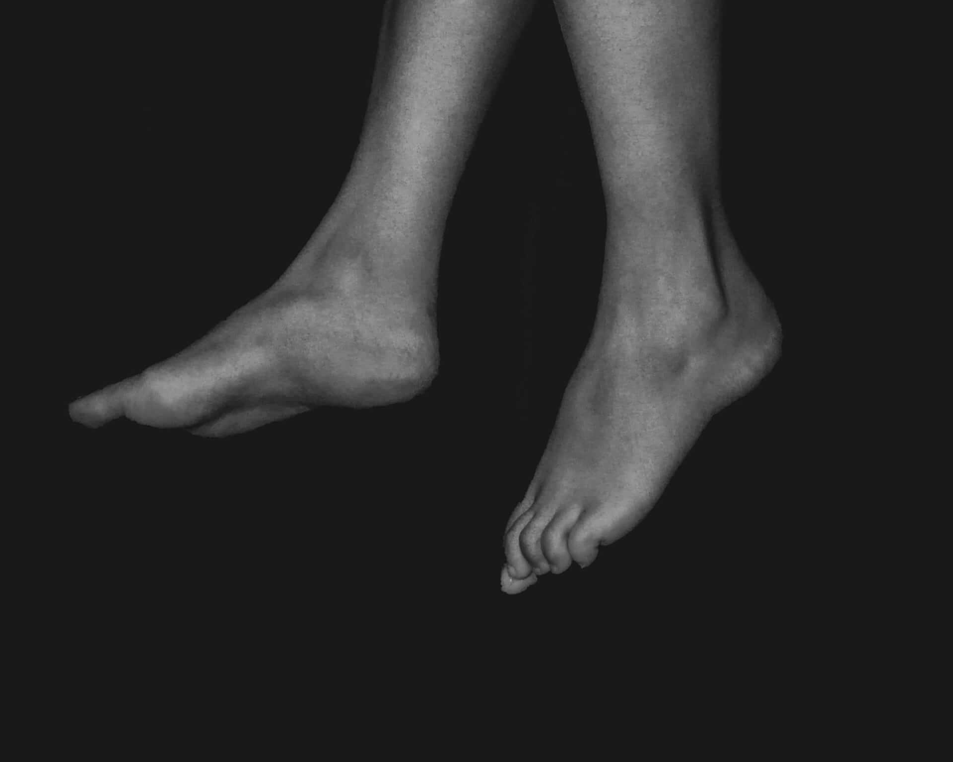 Complexe cheville-pied traumatise | Alizé - Syndicat de kinésithérapeutes