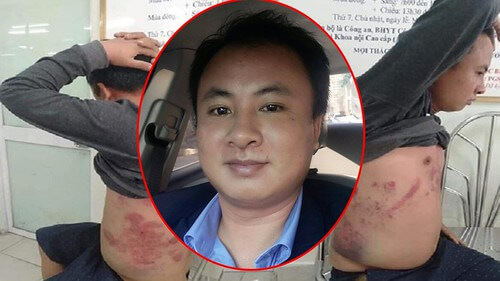 Bắt bớ, bỏ tù các tài xế là tiếp tay cho BOT "bẩn" | Vietnam Fraternité