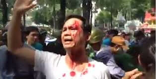 Đàn áp biểu tình chống Trung Quốc xâm lược bằng các biện pháp vi hiến. | Vietnam Fraternité