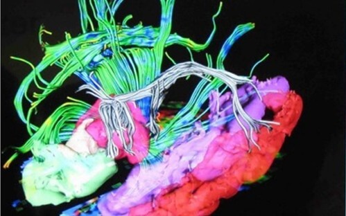 Triệt luận 4 : Chôn tâm hồn Việt… | Vietnam Fraternité