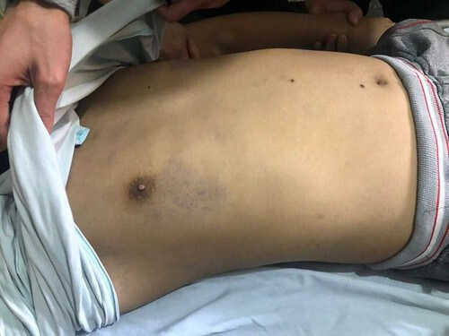 Chết trong trại tạm giam, start up Nam Hàn, làng dạo đòi đất | Vietnam Fraternité